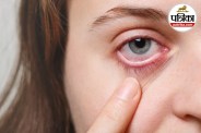 Graves Disease Symptoms Thyroid Eye Disease Symptoms