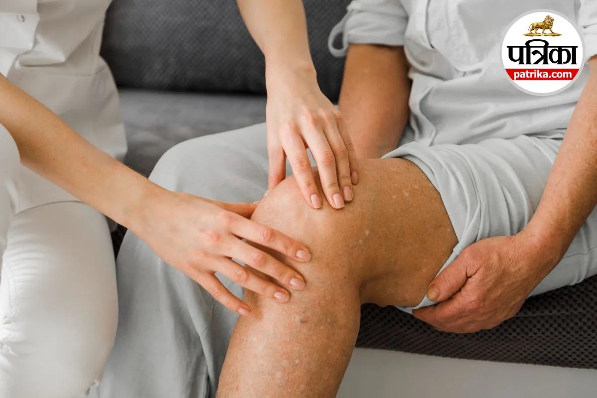 Varicose Veins, Varicose Eczema
