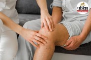 Varicose Veins, Varicose Eczema