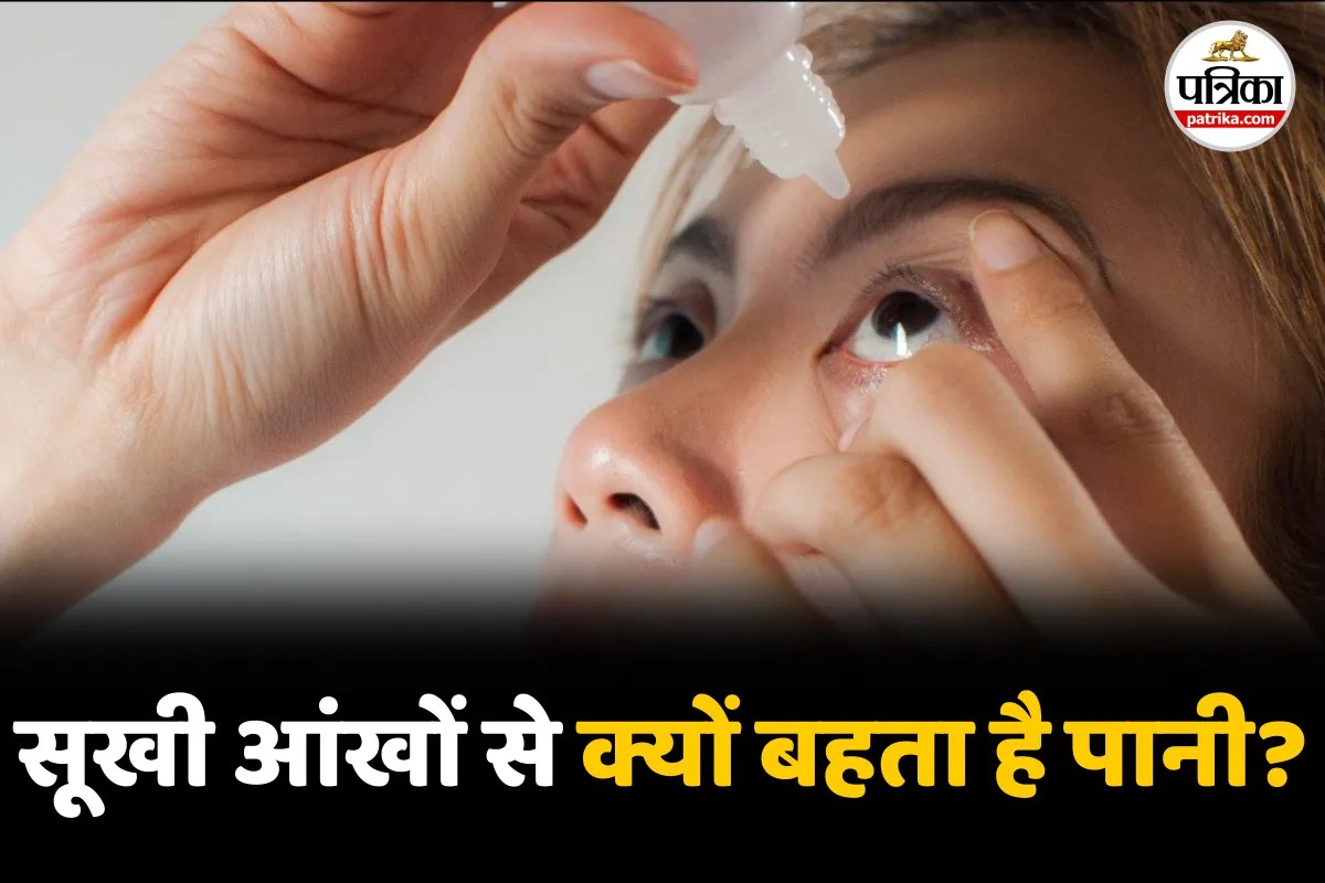 Dry Eyes Watery Eyes Burning Sensation Eye DRops