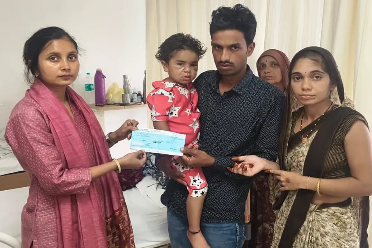 Plastic surgery performed in Indore on Hitanshi Jat from Dhar