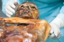 Otzi the Iceman mummy with ancient microbes.