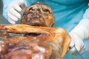 Otzi the Iceman mummy with ancient microbes.