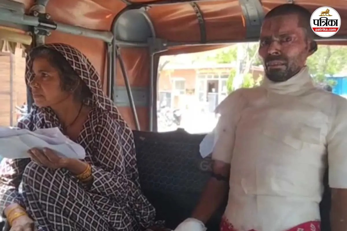 jalaun husband burnt