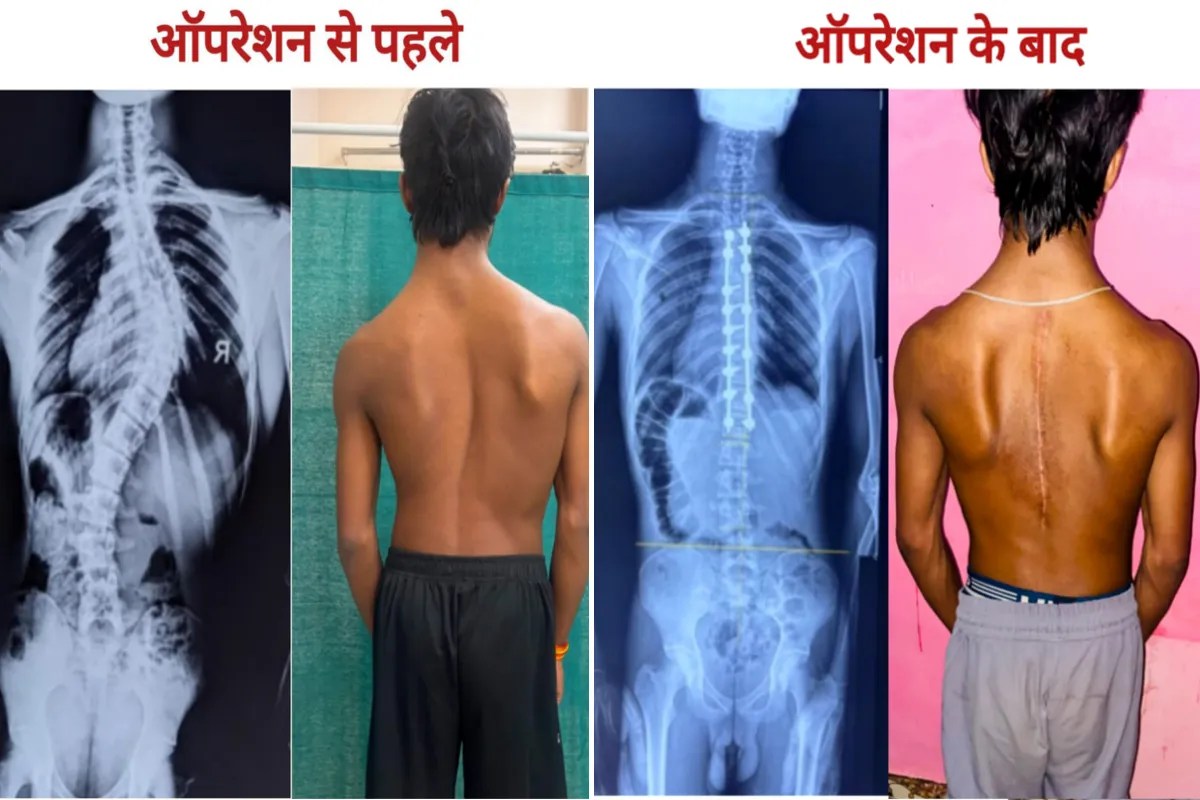 AIIMS Bhopal