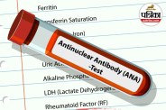 ANA Test in Hindi ANA Test Positive Meaning ANA Blood Test