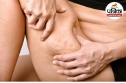 Cellulite Causes Cellulite Treatment Cellulite in Women