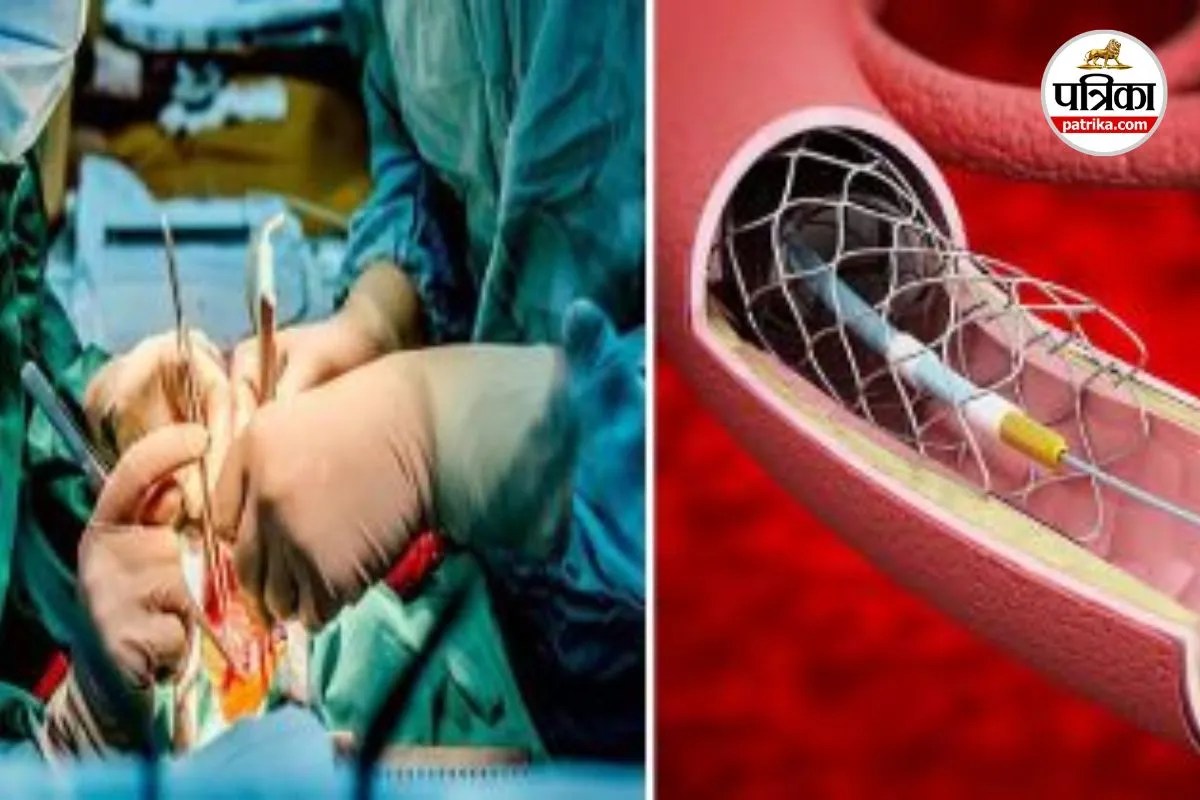 Chhattisgarh Heart Surgery