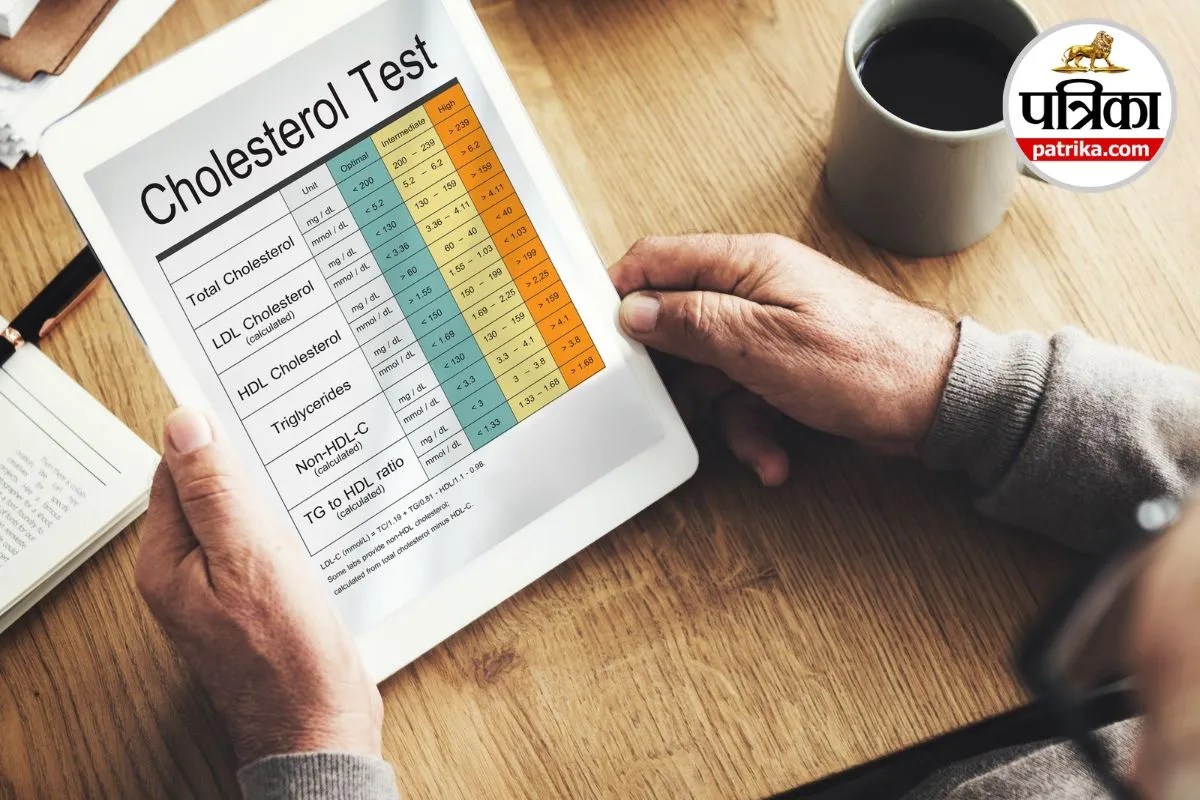 Cholesterol Test, Cholesterol Test at Age 20, Lipid Profile Test,