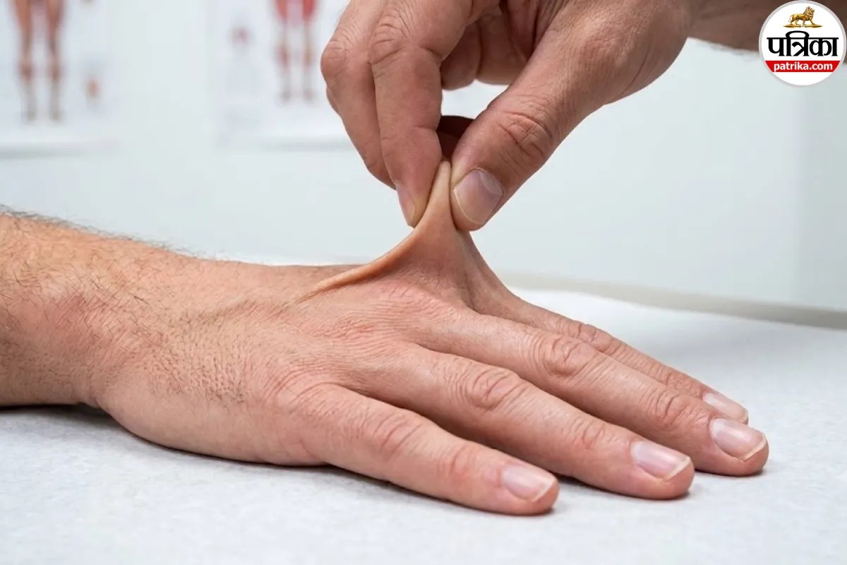 ehlers danlos syndrome types and symptoms,hypermobile eds joint pain fatigue,vascular eds rare genetic conditions,