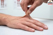 ehlers danlos syndrome types and symptoms,hypermobile eds joint pain fatigue,vascular eds rare genetic conditions,
