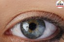Eye Cancer Symptoms,Ocular Melanoma Signs,Eye Tumor Warning Signs,