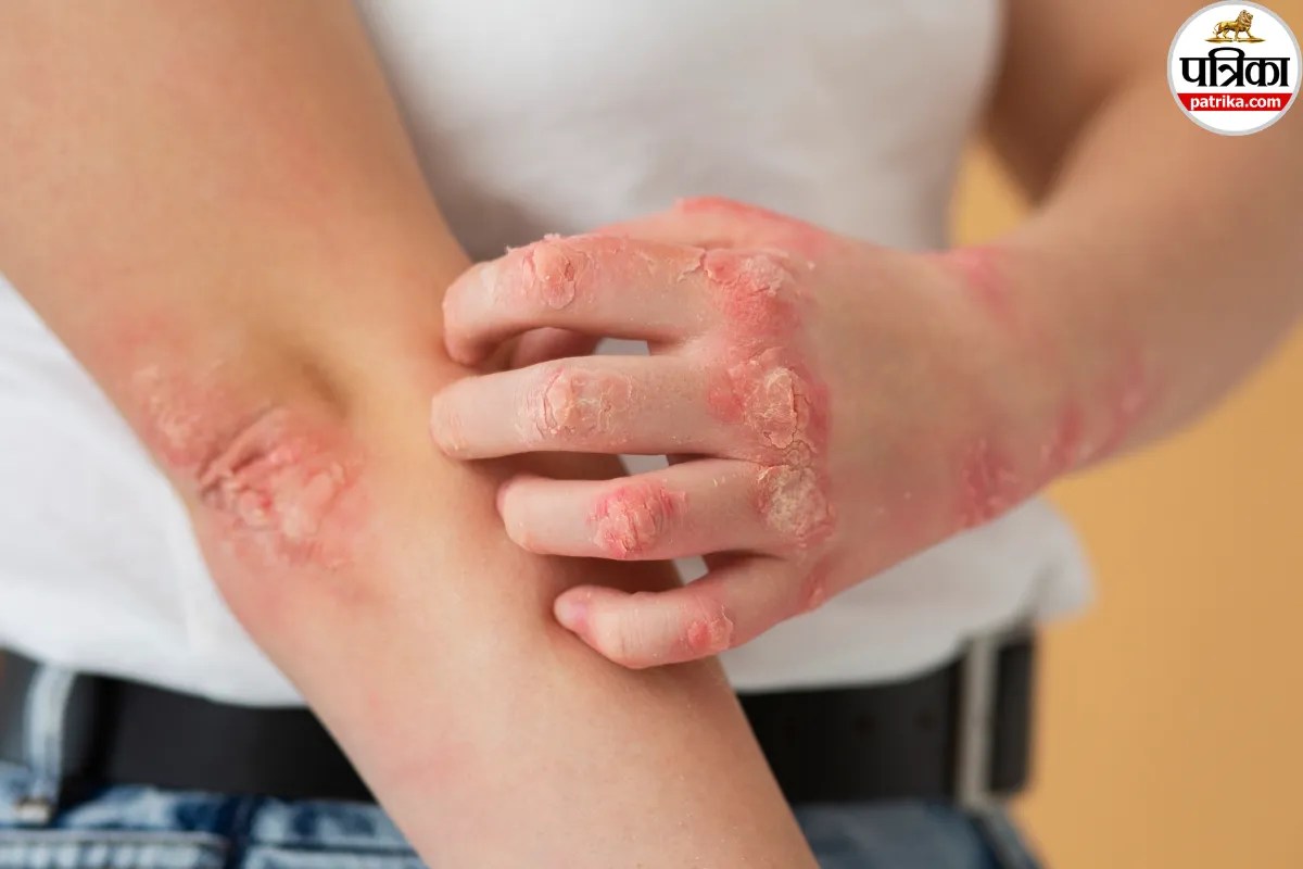 gangrene symptoms and causes,skin discoloration gangrene,infected wound foul smell