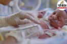 Gastroschisis cause and treatment,Moradabad gastroschisis baby news,Cleveland Clinic gastroschisis,