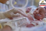 Gastroschisis cause and treatment,Moradabad gastroschisis baby news,Cleveland Clinic gastroschisis,
