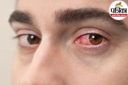Kawasaki disease symptoms in kids,Kawasaki disease signs in toddlers,High fever red eyes rash in child,