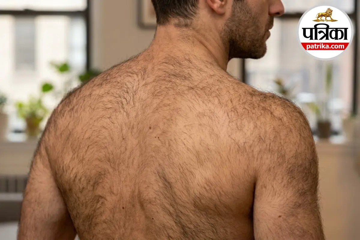 Lanugo hair in adults,Severe malnutrition skin symptoms,Anorexia nervosa symptoms lanugo,