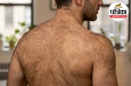 Lanugo hair in adults,Severe malnutrition skin symptoms,Anorexia nervosa symptoms lanugo,