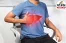 Causes of liver cirrhosis other than alcohol,Non alcoholic causes of liver cirrhosis,Can fatty liver cause cirrhosis,