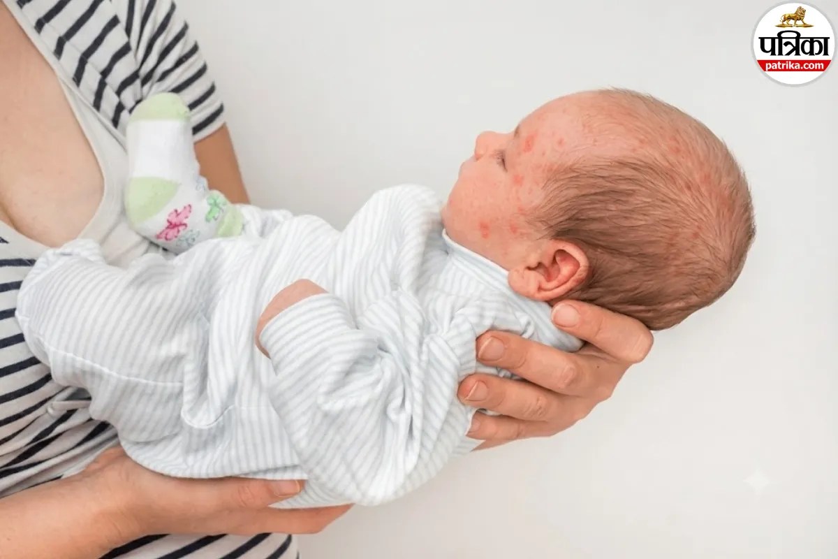 Neonatal herpes symptoms,Herpes in newborn baby,Infant blisters and fever,