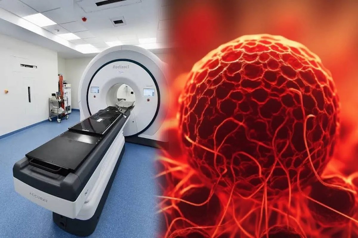 Cancer treatment: कैंसर कोशिकाओं को नष्ट करेगी 42 करोड़ की मशीन (Photo Source- freepik)