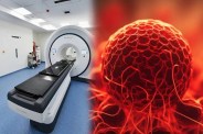 Cancer treatment: कैंसर कोशिकाओं को नष्ट करेगी 42 करोड़ की मशीन (Photo Source- freepik)
