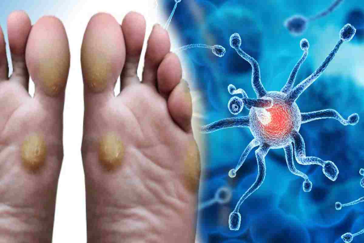 Cancer:बायोप्सी में निकला साइनोवियल सार्कोमा नामक दुर्लभ कैंसर (Photo Source- freepik)