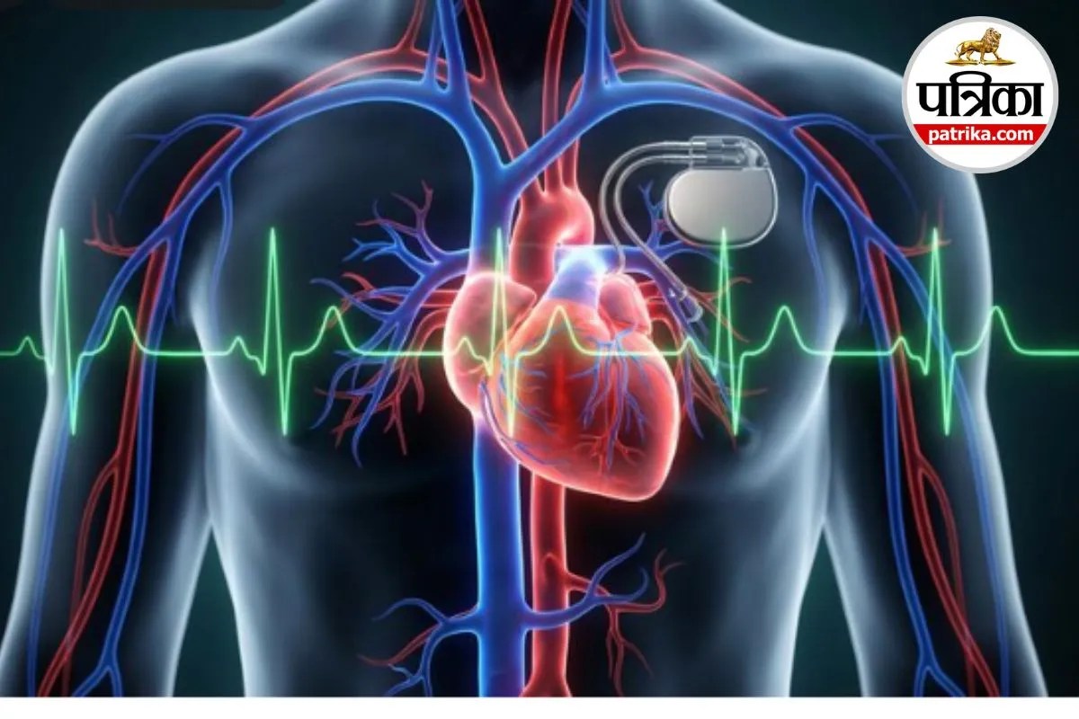 Pacemaker After Surgery Care Pacemaker Side Precautions Heart Rhythm Disorder