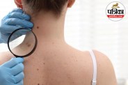 skin cancer cause, non melanoma cancer cause, non melanoma cancer Symptoms