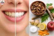 Natural Teeth Whitening, Remove Yellow Teeth Naturally
