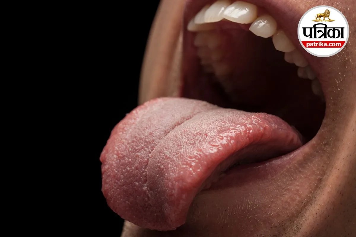 Oral Cancer Symptoms Mouth Cancer HPV Infection