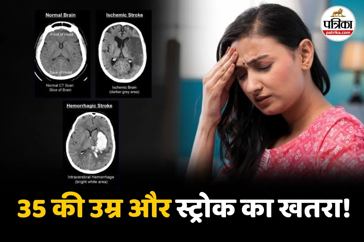 Brain stroke Headache Stress Thrombolysis Emergency Kit