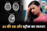 Brain stroke Headache Stress Thrombolysis Emergency Kit