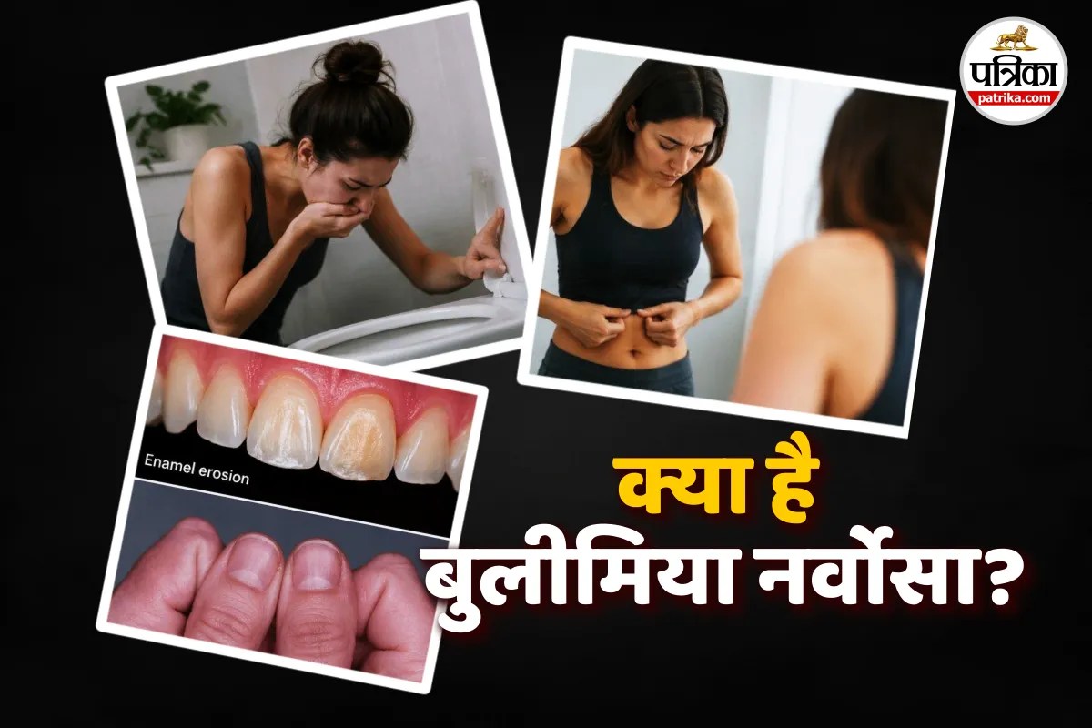 Bulimia Nervosa Behaviour Changes Symptoms Eating Disorder