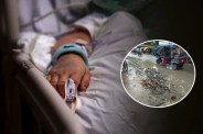 Viral Infections Cases Rise