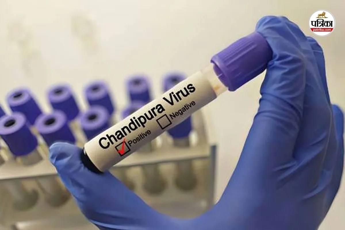 Chandipura Virus