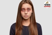Dark Circles Symptoms Dark Circles Causes Hindi Eye Dark Circles