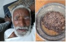 नंदवाण गांव का बुजुर्ग जिसके चेहरे पर मु​िक्खयों के डंक और थाली में भरी म​िक्खयां जो उसके पेट से निकाली गई।