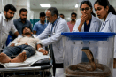 Mandsaur Snake Bit