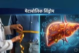 Metabolic syndrome