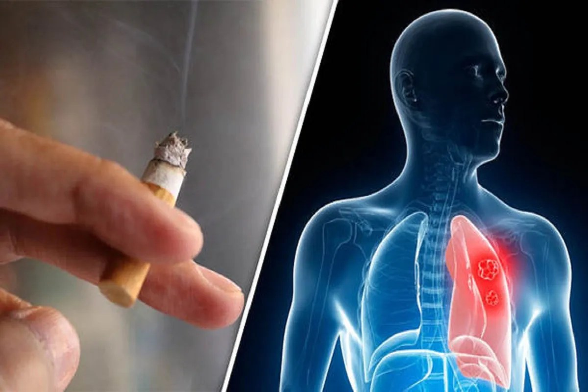 World Lung Cancer Day