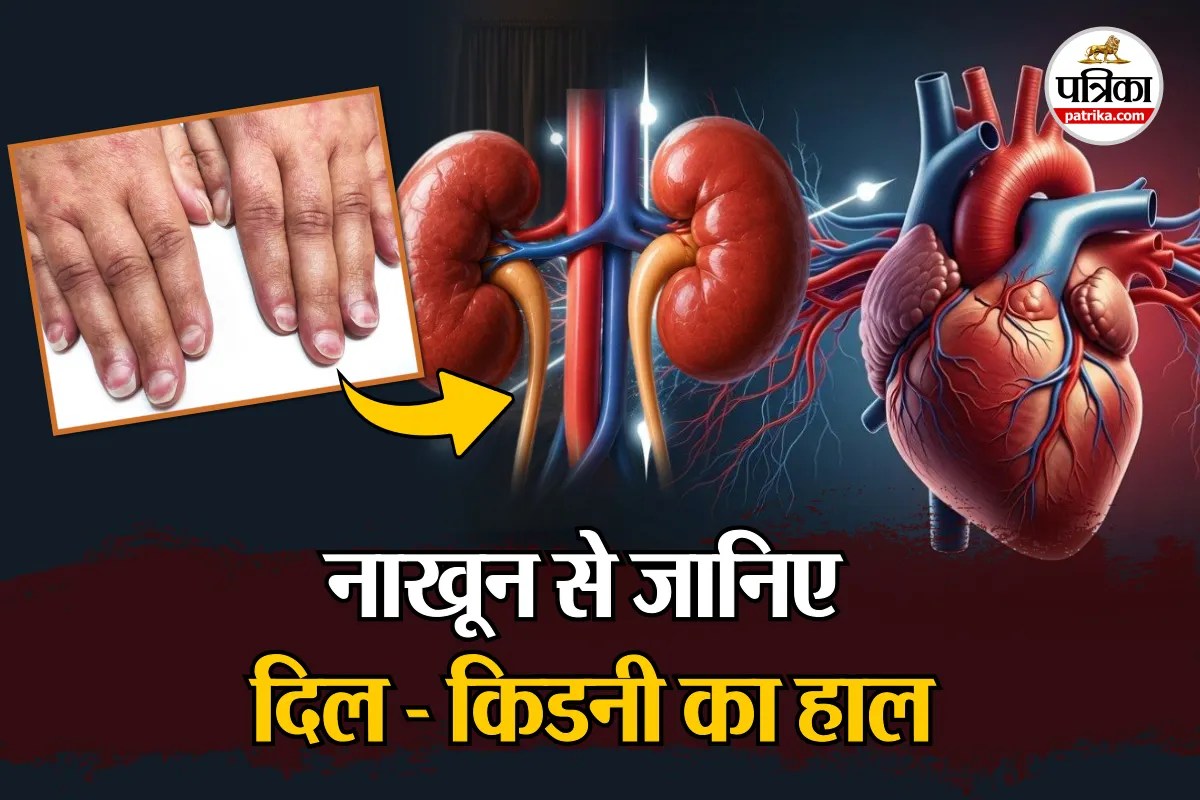 Kidney Heart Half moon nails Lipid Profile