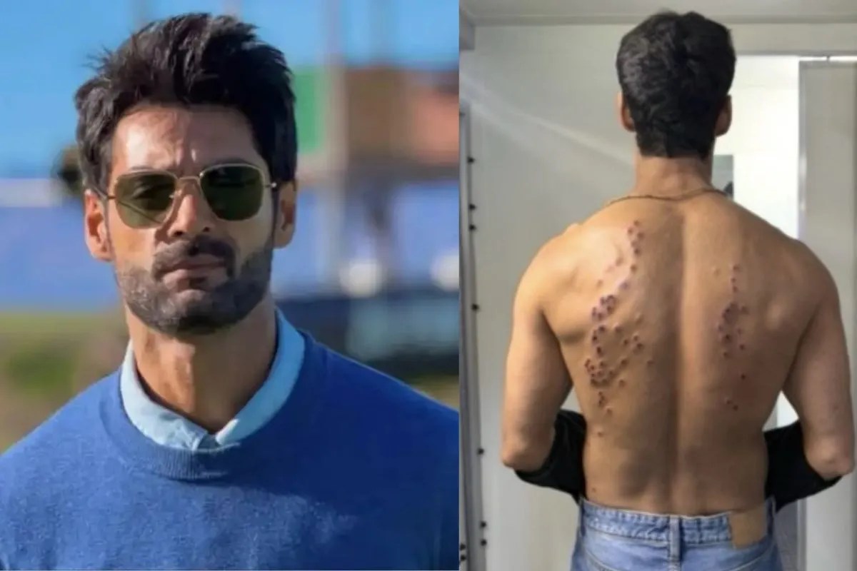 Khatron Ke Khiladi 15 Karan Wahi rubber bullet injuries after gaurav khanna said this season is scariest
