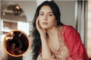 Shehnaaz Gill swallows nose ring during on shooting set fans scared