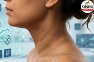 Acanthosis Nigricans Causes,Dark Neck Insulin Resistance, Velvety Skin Underarms,