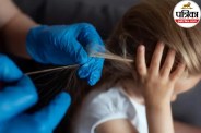 Body lice symptoms,Causes of body lice,How to get rid of body lice,