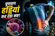 Bone fracture without injury due to cancer multiple myeloma
