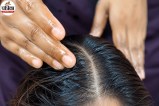 Hair Oiling Tips, Scalp Massage