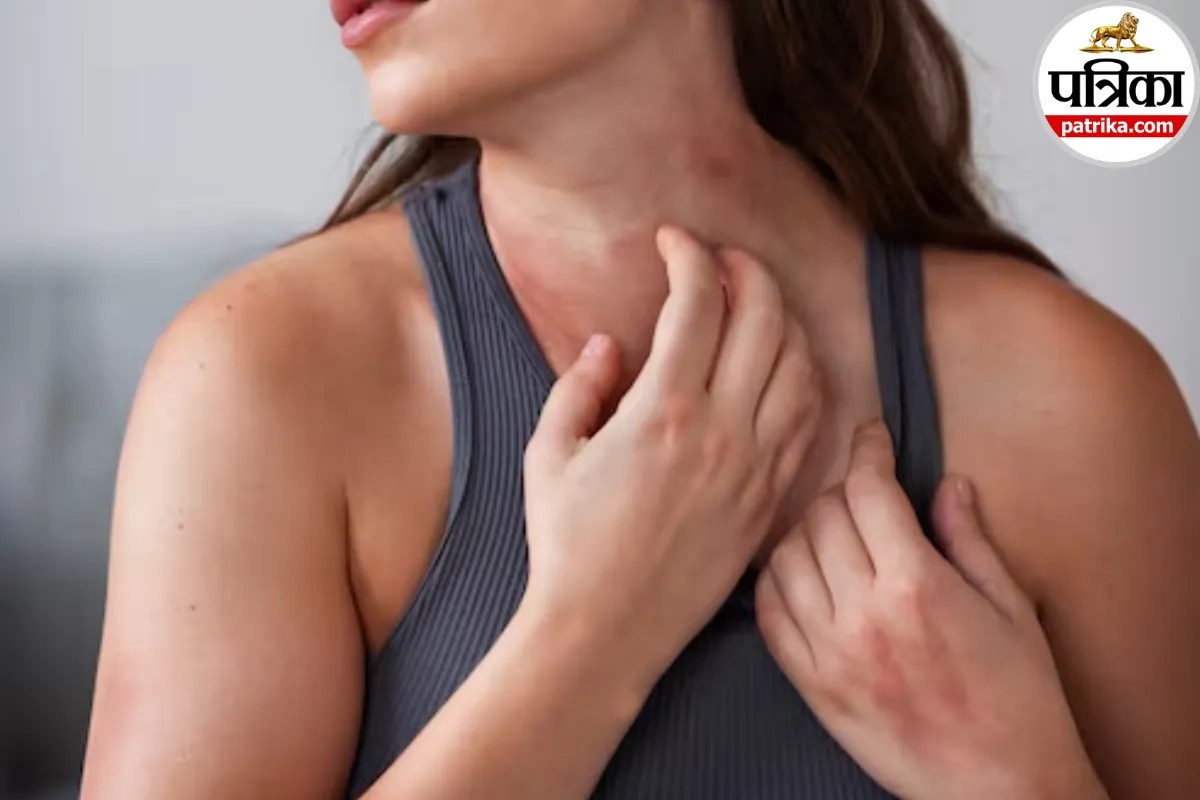 Hidradenitis suppurativa symptoms,Painful recurrent boils causes,Hidradenitis suppurativa treatment,