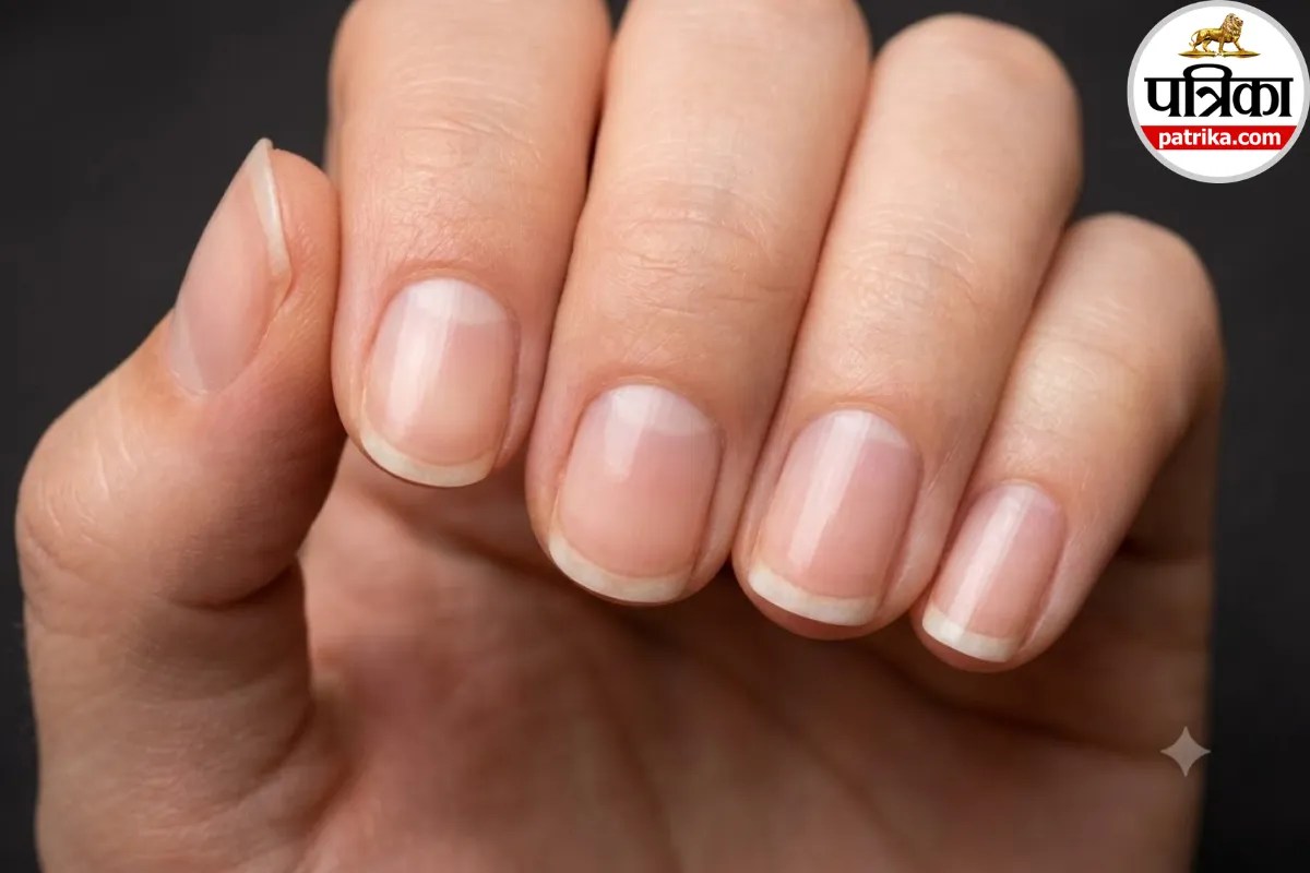 White Spots on Nails Causes,Leukonychia Symptoms and Treatment,Zinc Deficiency Nail Signs,